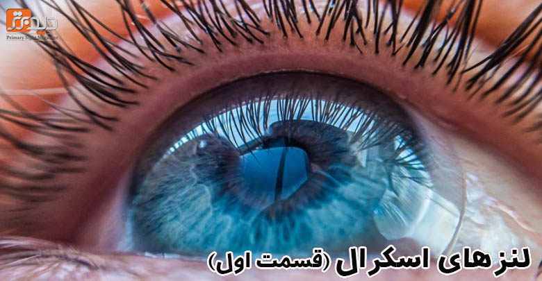 لنز اسکرال و کاربرد آن